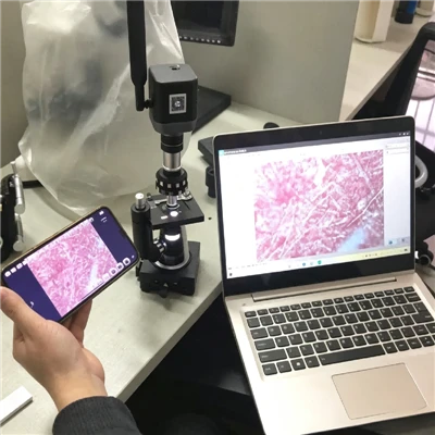 Detectarea microscopică a incluziunilor ne-metalice